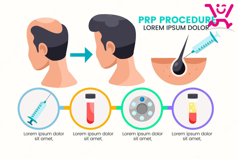 پی آر پی PRP چیست